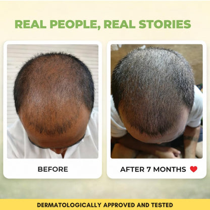 Amritansh Khadi Natural Hair Oil, Ayurvedic Herbal Oil for Women and Men, SLS & Paraben Free - back view