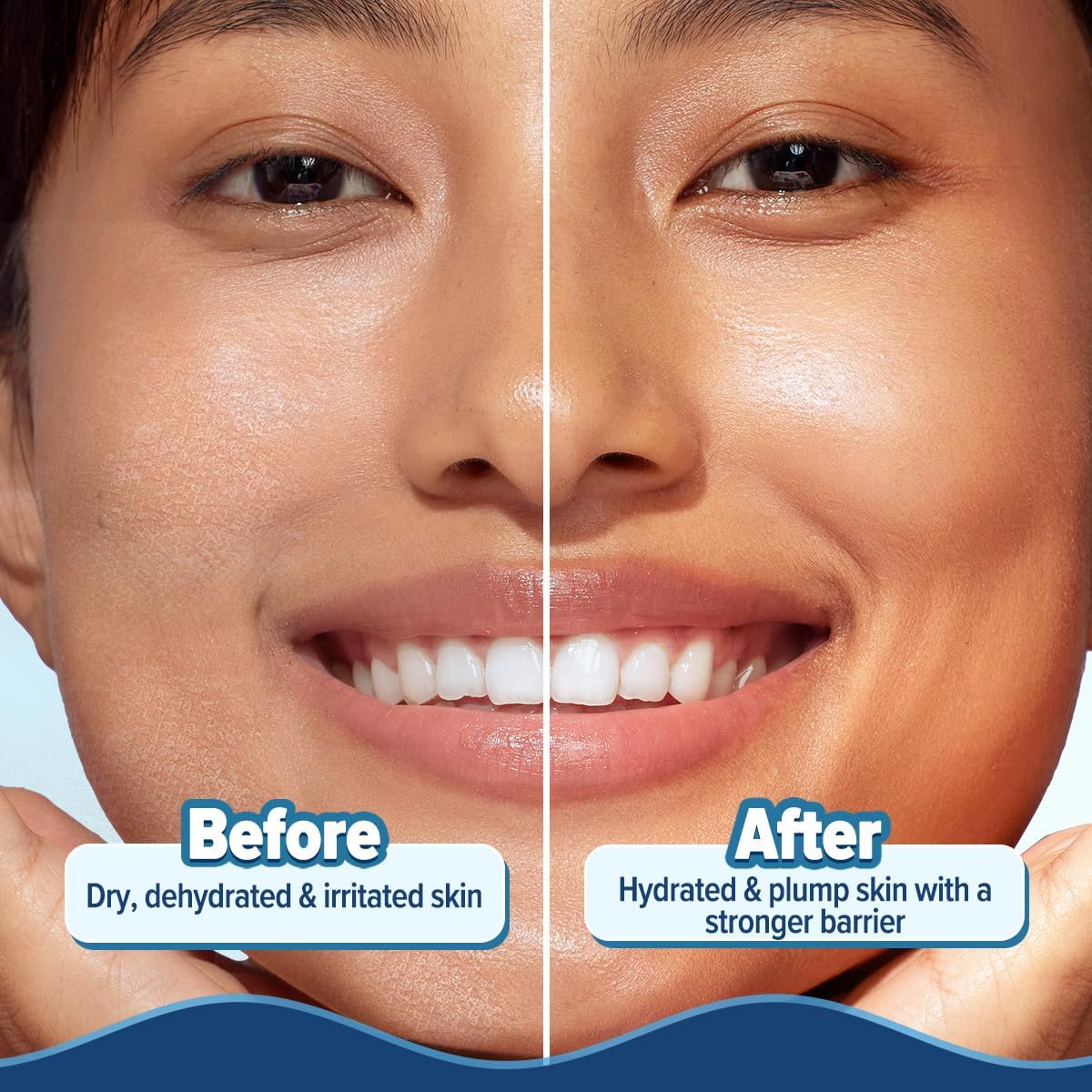 Aqualogica 5 Barrier+ Hydra Gel Moisturizer with Avocado & Ceramides, 200g, Pack of 2 - packaging