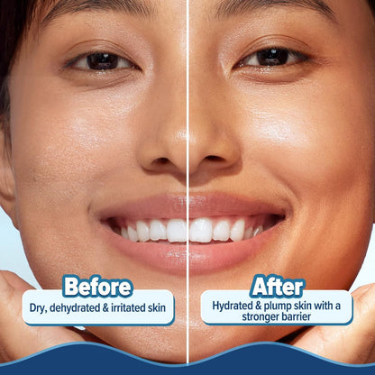 Aqualogica 5 Barrier+ Hydra Gel Moisturizer with Avocado & Ceramides, 200g, Pack of 2 - packaging