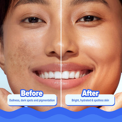 Aqualogica Bright+ Hydra Gel Moisturizer with Blueberry & Kojic Acid, 200g - ingredients panel