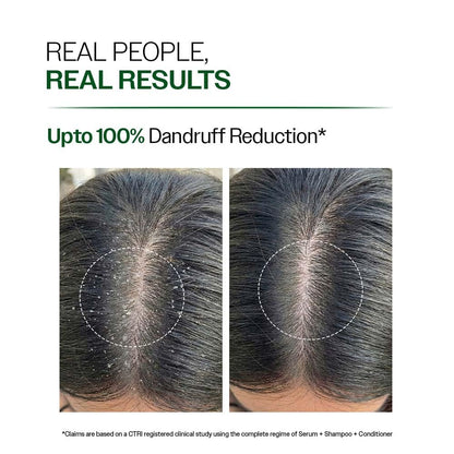 Bare Anatomy Anti-Dandruff Conditioner with Biotin and Rosemary, Hair Conditioner for All Hair Types - packaging (22)