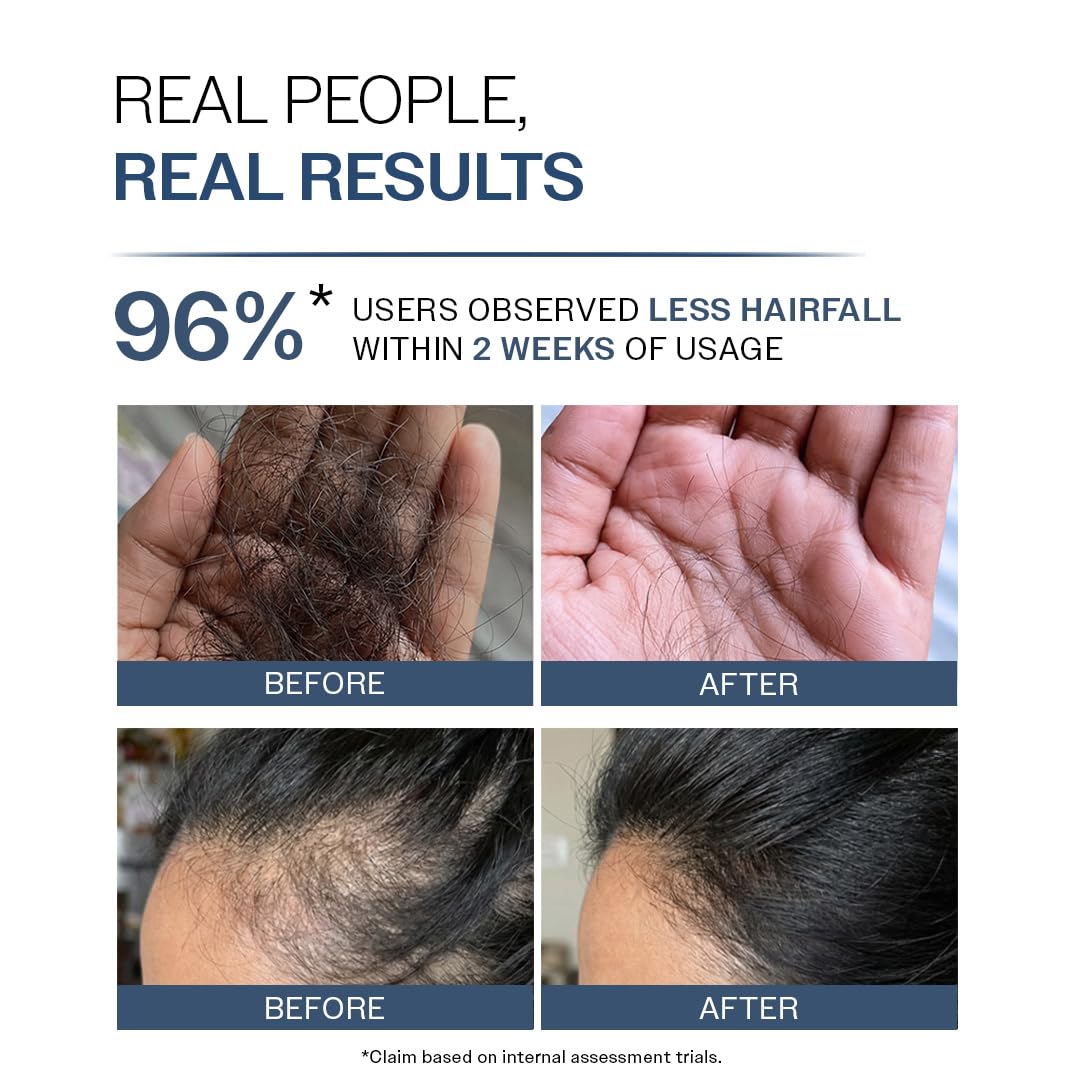 Bare Anatomy Hair Conditioner with Redensyl, Rosemary & Peptides - in use (55)