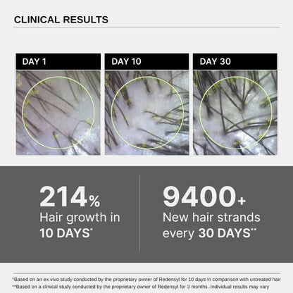 Bare Anatomy Hair Conditioner with Redensyl, Rosemary & Peptides - size and scale (61)