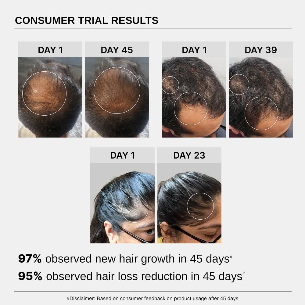 Bare Anatomy Hair Conditioner with Redensyl, Rosemary & Peptides - packaging (71)