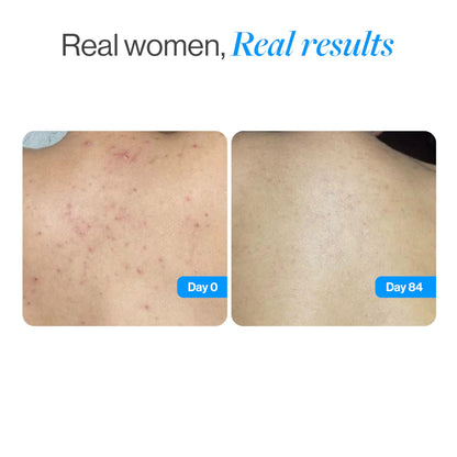 Be Bodywise Salicylic Acid Exfoliating Body Wash Gel for All Skin Types - label detail (37)