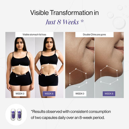 Beautywise Dual Action Body Shape | Weight Management | Helps Convert Fat into Energy Supplement for Men & Women (30 Capsules