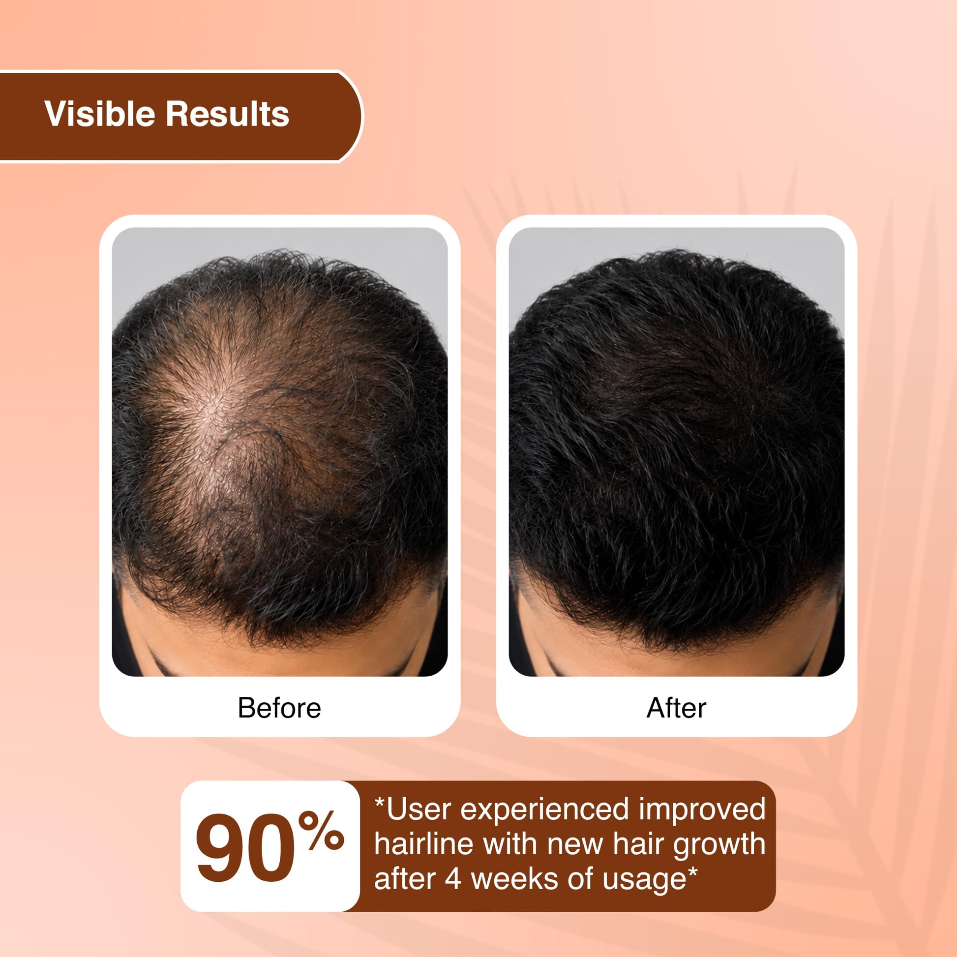 Biopanth Advanced Hair Growth & Scalp Serum – 3% Redensyl, 4% Anagain, 2% Baicapil, Caffeine & Keratin | Hair Fall Control Se
