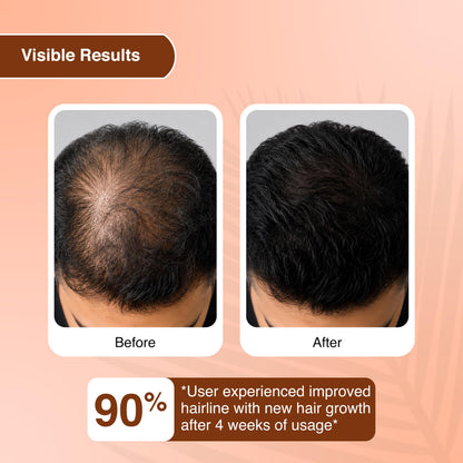 Biopanth Advanced Hair Growth & Scalp Serum – 3% Redensyl, 4% Anagain, 2% Baicapil, Caffeine & Keratin | Hair Fall Control Se