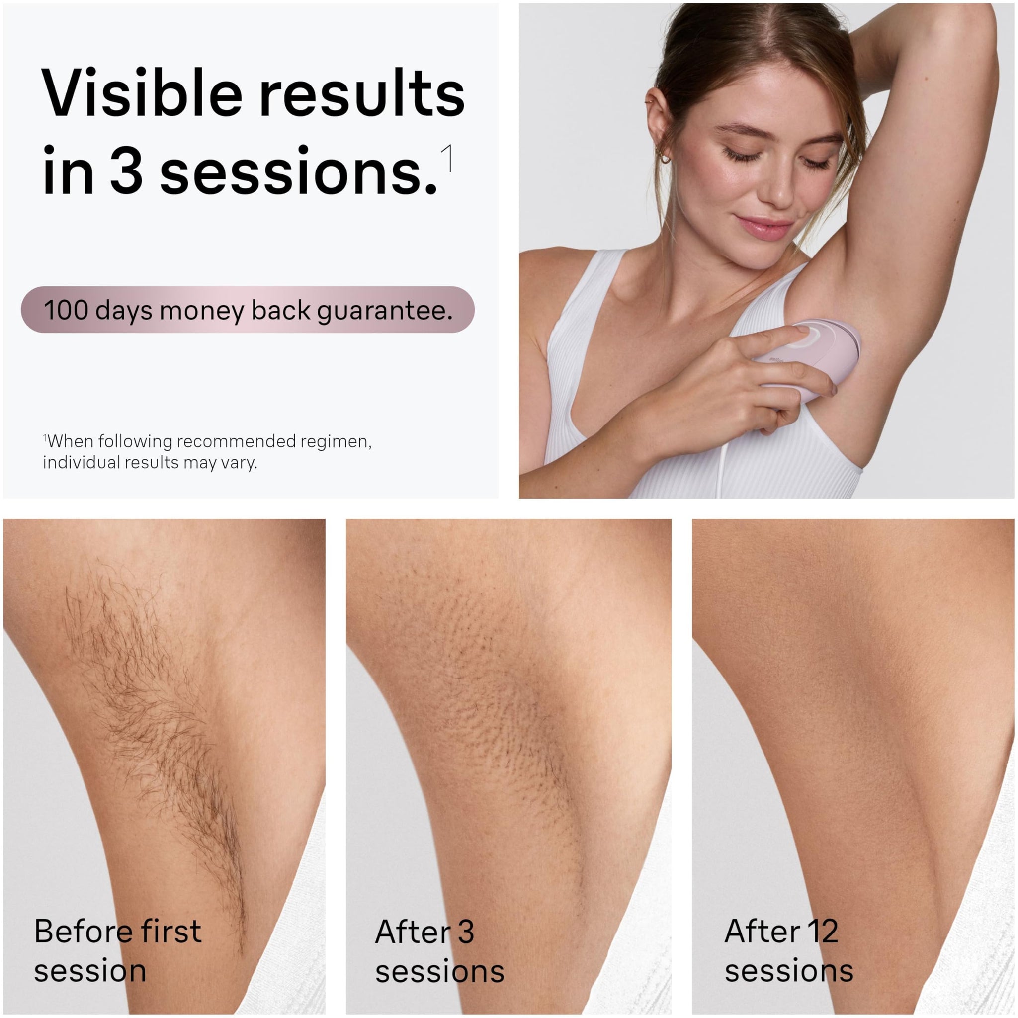Braun Silk-Expert Mini IPL1111 Wired IPL Hair Removal Device, Home Use, with Bag and Venus Razor - back view