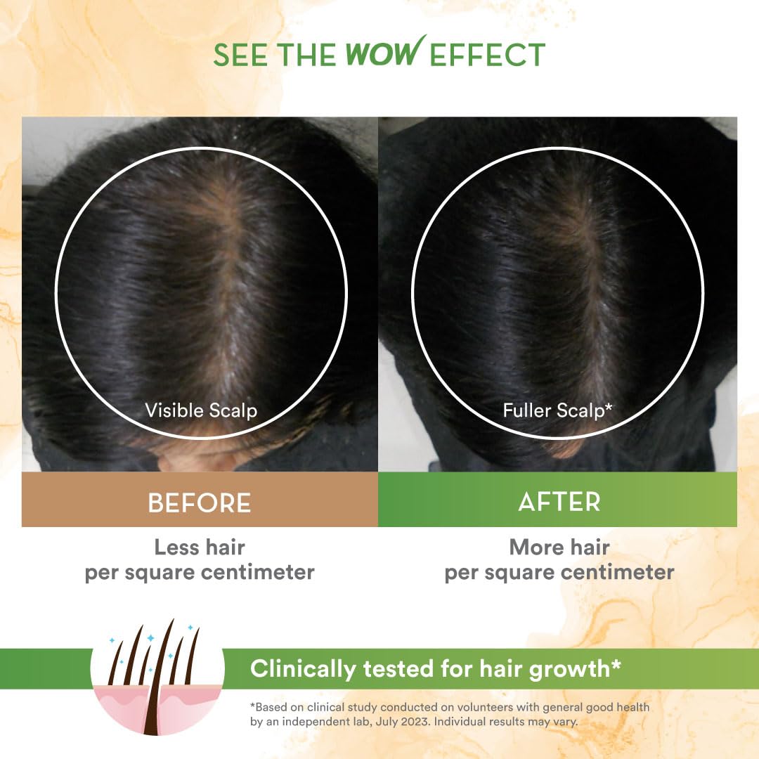 BUYWOW WOW Skin Science Rosemary & Biotin Shampoo, 250ml, Unisex Hair Cleanser - label detail