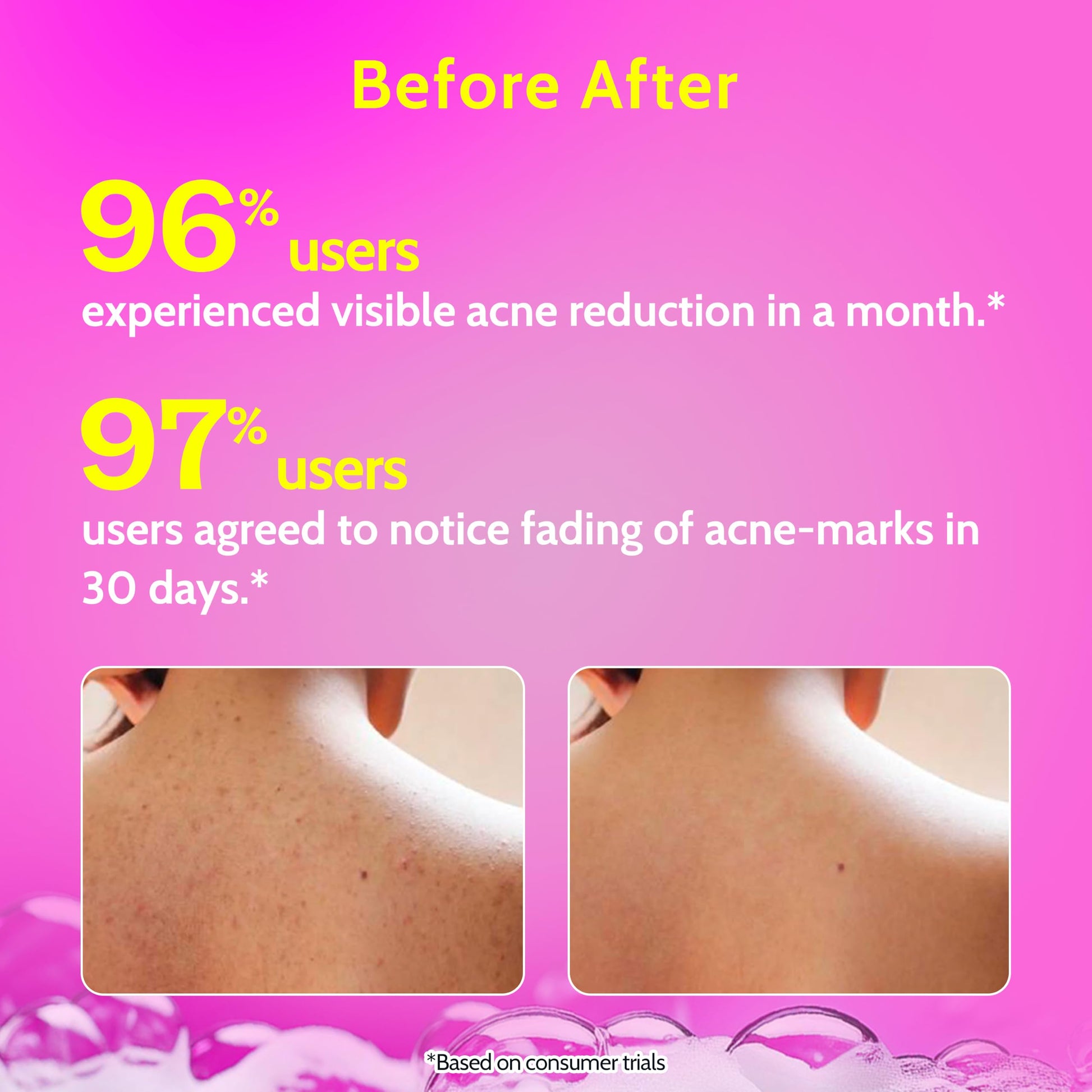 Chemist at Play 1% Salicylic Acid Body Wash, Paraben & SLS Free, Beauty, Unisex - back view (10)
