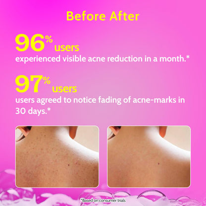 Chemist at Play 1% Salicylic Acid Body Wash, Paraben & SLS Free, Beauty, Unisex - back view (10)
