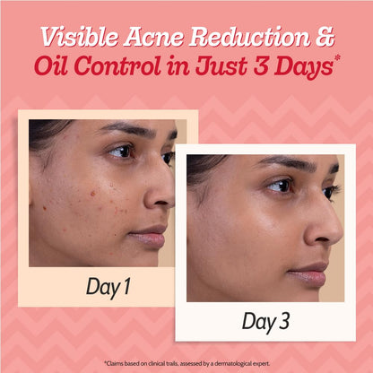 Chemist at Play 2% Salicylic Acid Face Serum, Non-Comedogenic, Dermatologist-Tested, Unisex - back view (12)