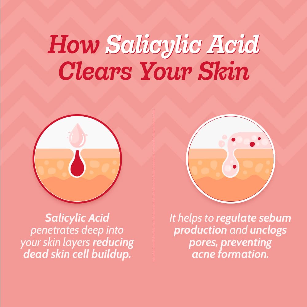 Chemist at Play 2% Salicylic Acid Face Serum, Non-Comedogenic, Dermatologist-Tested, Unisex - in use (17)