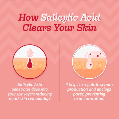 Chemist at Play 2% Salicylic Acid Face Serum, Non-Comedogenic, Dermatologist-Tested, Unisex - in use