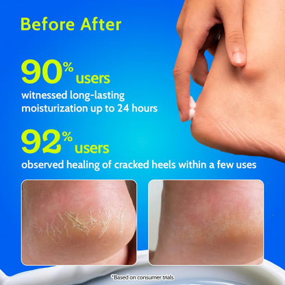 Chemist at Play Foot Cream for Cracked Heels, 50g, Urea-Based Formula, Unisex Adult - ingredients panel (15)