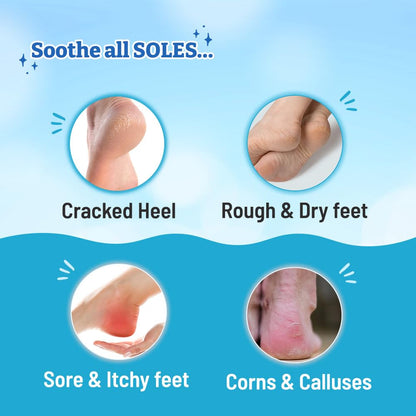 Chemist at Play Foot Cream for Cracked Heels, 50g, Urea-Based Formula, Unisex Adult - close-up detail