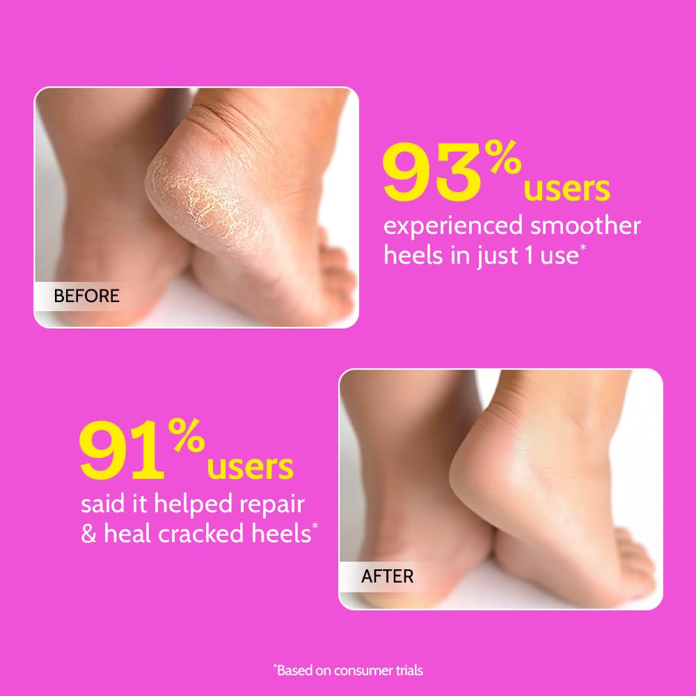 Chemist at Play Foot Roll-on, 50gm, with 20% Urea, Salicylic Acid, and Glycolic Acid, Fragrance-Free, Vegan - close-up detail