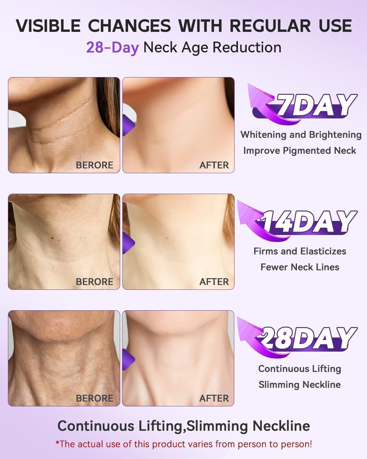 Easiqo Neck Cream with Hyaluronic Acid, Cupuaçu Butter, Matridust and Caffeine, 100g - back view