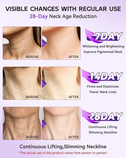 Easiqo Neck Cream with Hyaluronic Acid, Cupuaçu Butter, Matridust and Caffeine, 100g - back view