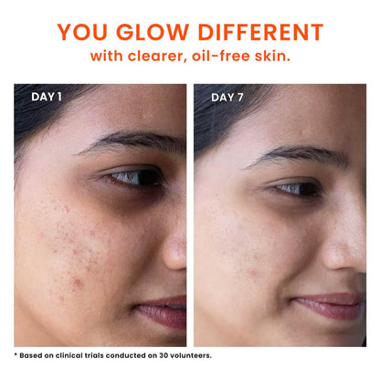 FoxTale Face Wash with 2% Salicylic Acid and Niacinamide for Oily and Acne-Prone Skin - label detail
