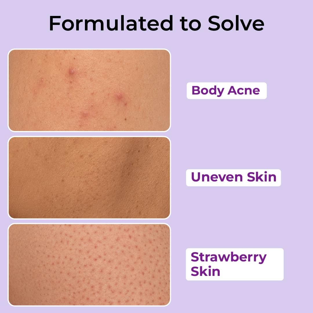 FoxTale Hula Hoop 8% De-Tan Body Wash, 2x250ml, with Niacinamide, Glycolic Acid & Salicylic Acid, Unisex - in use (24)