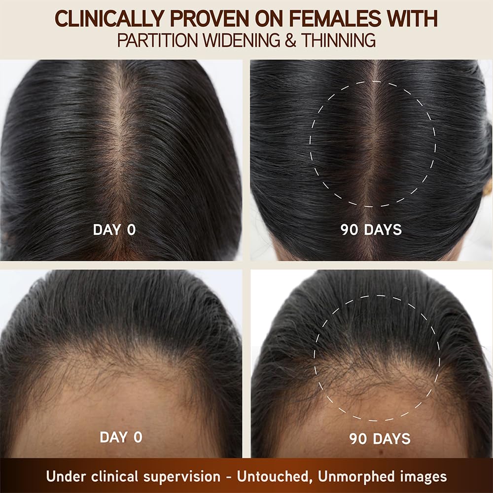 Indulekha Bringha Scalp Serum, 30ml, Ayurvedic Hair, 30g, Hair Regrowth Treatments - label detail