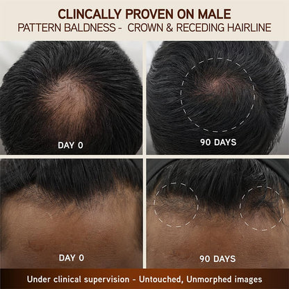 Indulekha Bringha Scalp Serum, 30ml, Ayurvedic Hair, 30g, Hair Regrowth Treatments - ingredients panel