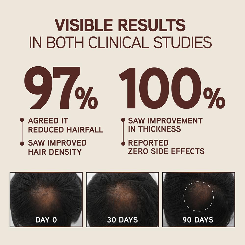 Indulekha Bringha Scalp Serum, 30ml, Ayurvedic Hair, 30g, Hair Regrowth Treatments - in use