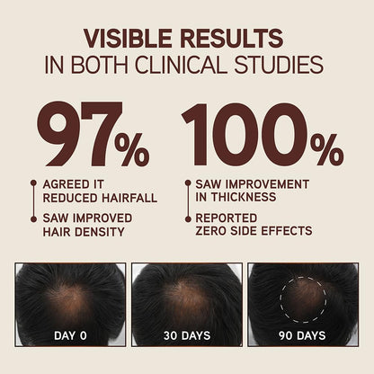 Indulekha Bringha Scalp Serum, 30ml, Ayurvedic Hair, 30g, Hair Regrowth Treatments - in use