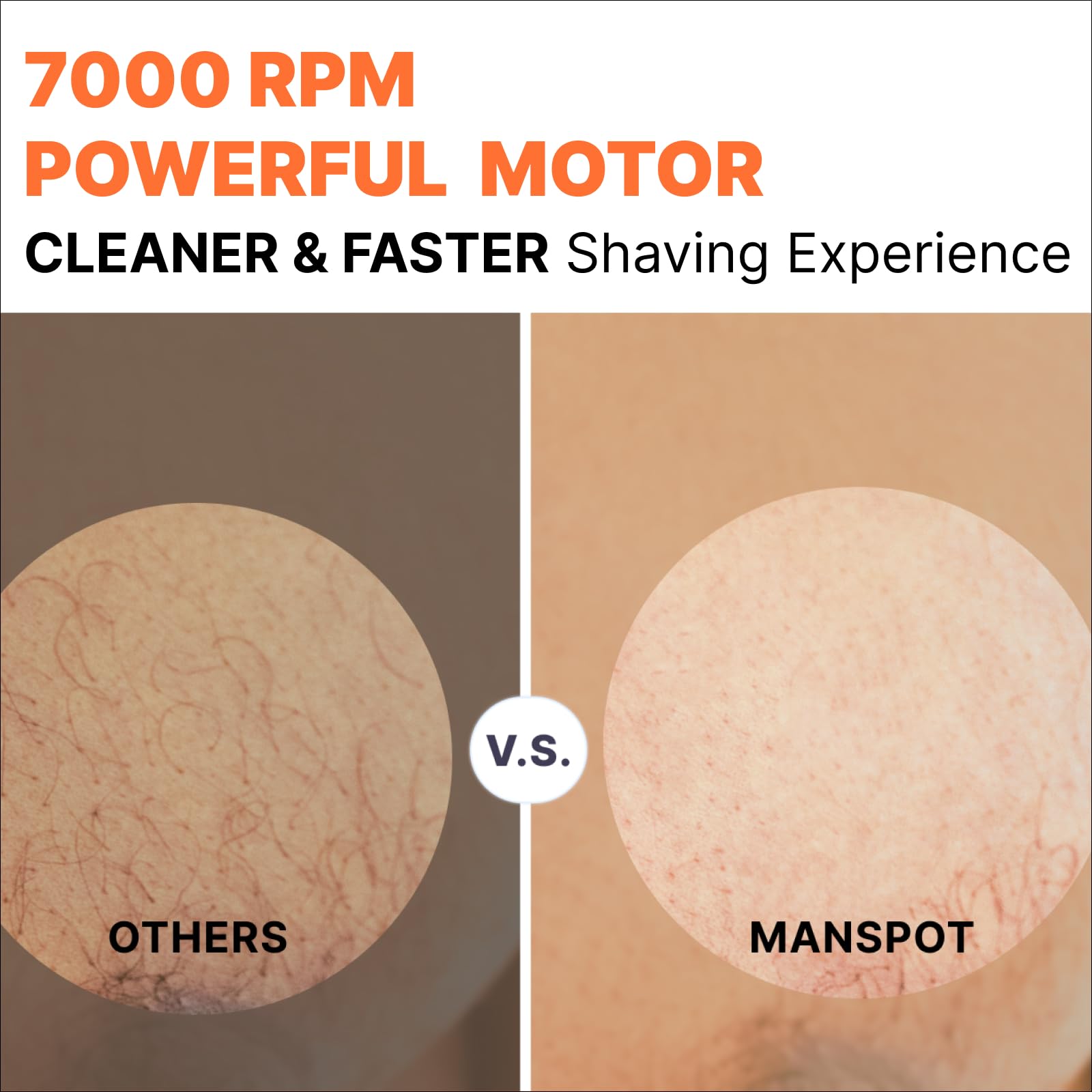 MANSPOT Body Hair Trimmer for Men with Ceramic Blade, IPX7 Waterproof, Rechargeable with 4 Guide Lengths - packaging (13)