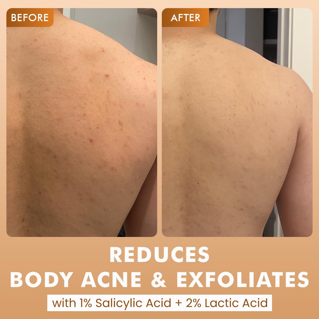 mcaffeine 7% Exfoliating Body Wash Gel, 300ml, 1% Salicylic and 2% Lactic Acid, Unisex - front view (17)
