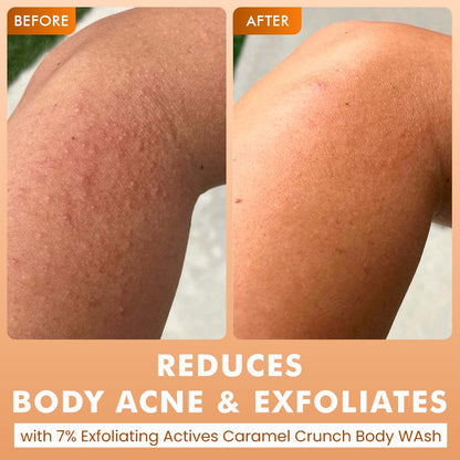 mcaffeine Body Wash Gel with Mandelic Acid Salicylic Acid and Brightening Actives, Unisex Adult - packaging (22)