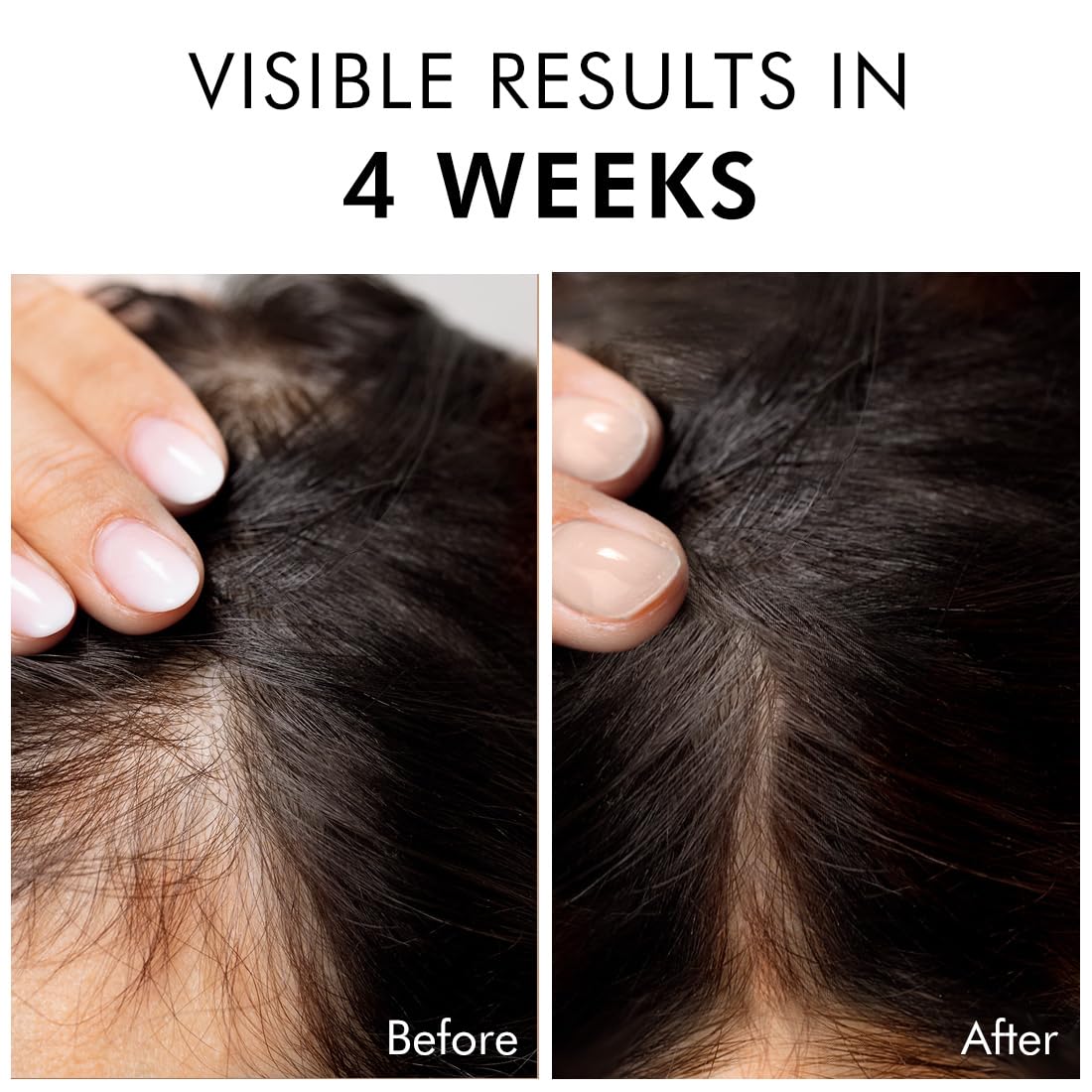 Mcaffeine Serum With 20% Caffexil Advanced, Biotin, Keratin & Rosemary | 80% Hair Growth, Increase Density & Control Fall | N