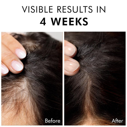 Mcaffeine Serum With 20% Caffexil Advanced, Biotin, Keratin & Rosemary | 80% Hair Growth, Increase Density & Control Fall | N
