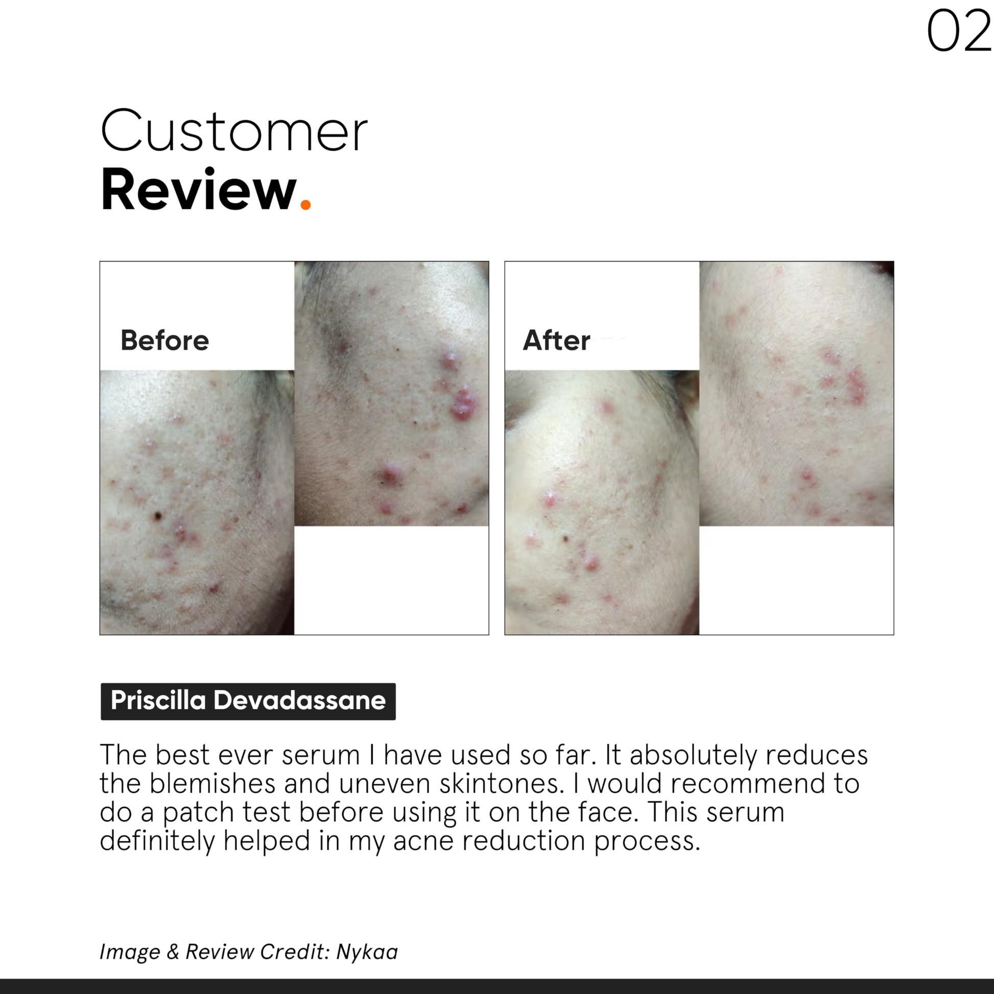 Minimalist 10% Niacinamide Serum with Zinc, Face Serum for Oily & Acne-Prone Skin, Vitamin B3, Fragrance-Free, Non-Comedogeni