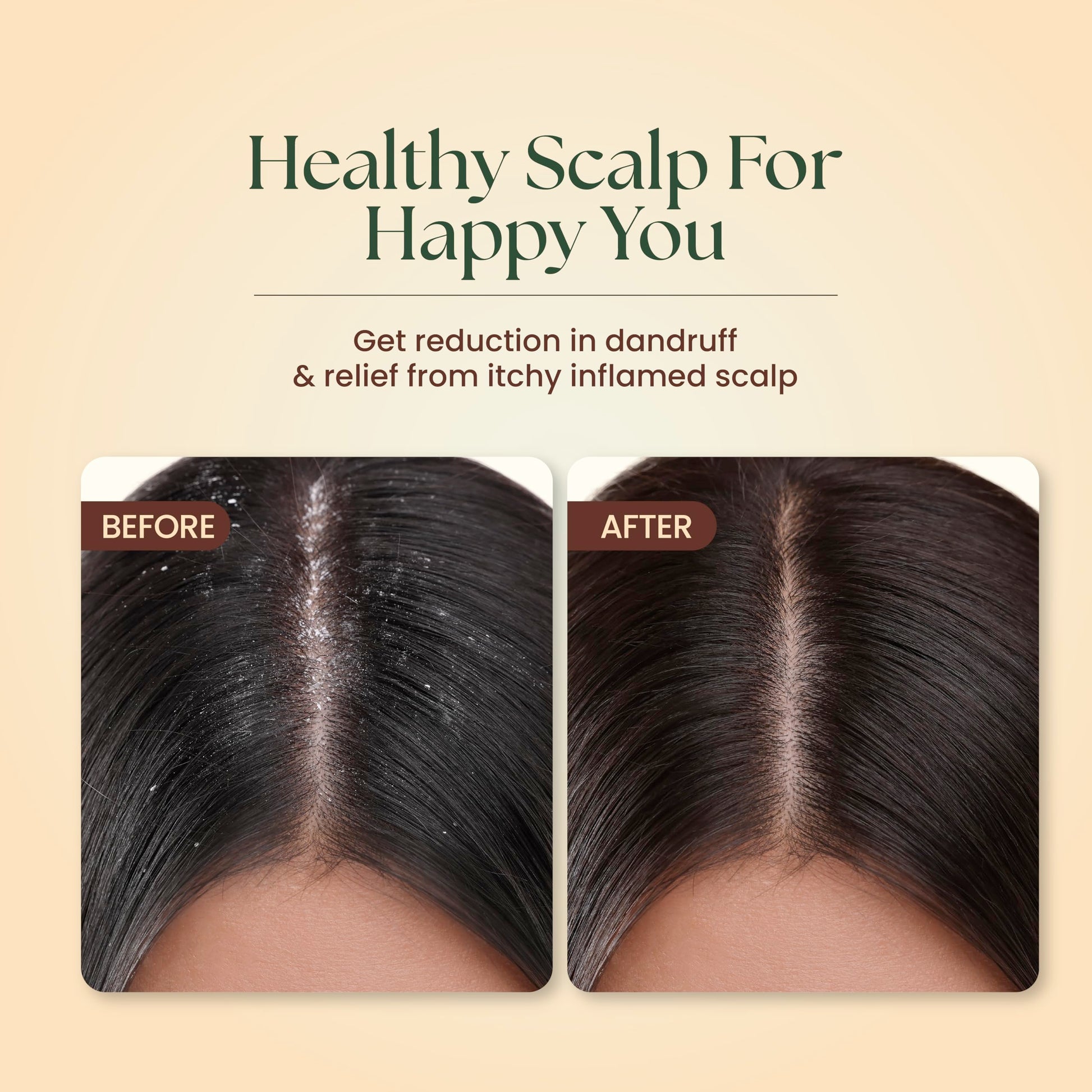 Moha Herbal Shampoo With Amla, Aloe, Bhringraj & Brahmi for Cleansing, Nourishing & Strengthens Hair Roots and Scalp | Hair G