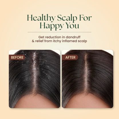 Moha Herbal Shampoo With Amla, Aloe, Bhringraj & Brahmi for Cleansing, Nourishing & Strengthens Hair Roots and Scalp | Hair G