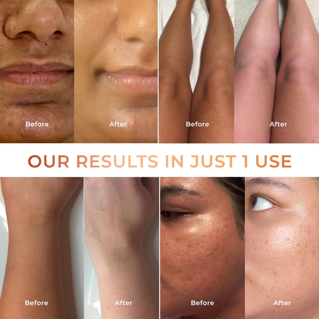 NICONI Tan Vanish Gluta-Kojic Skin Polish, 180g, Facial Scrub & Polish - label detail