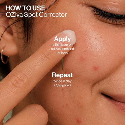 OZiva Acne Spot Corrector Gel, 5% Green Tea Extract, 1% Willow Bark, 20g - in use