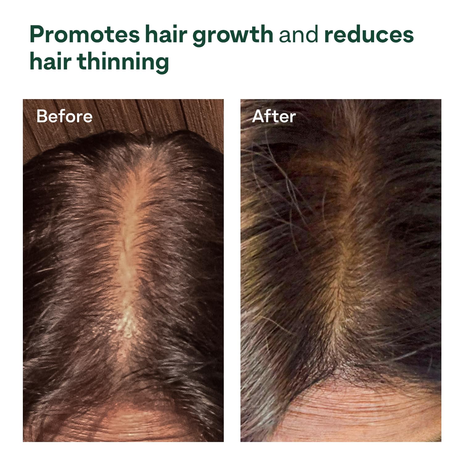 OZiva Hair Growth Serum for Scalp with Redensyl and Lindera Root Extract - label detail