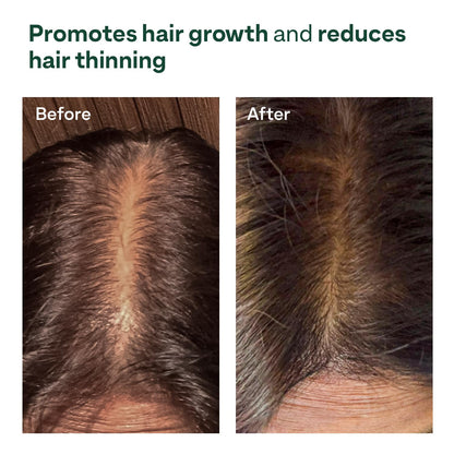 OZiva Hair Growth Serum for Scalp with Redensyl and Lindera Root Extract - label detail