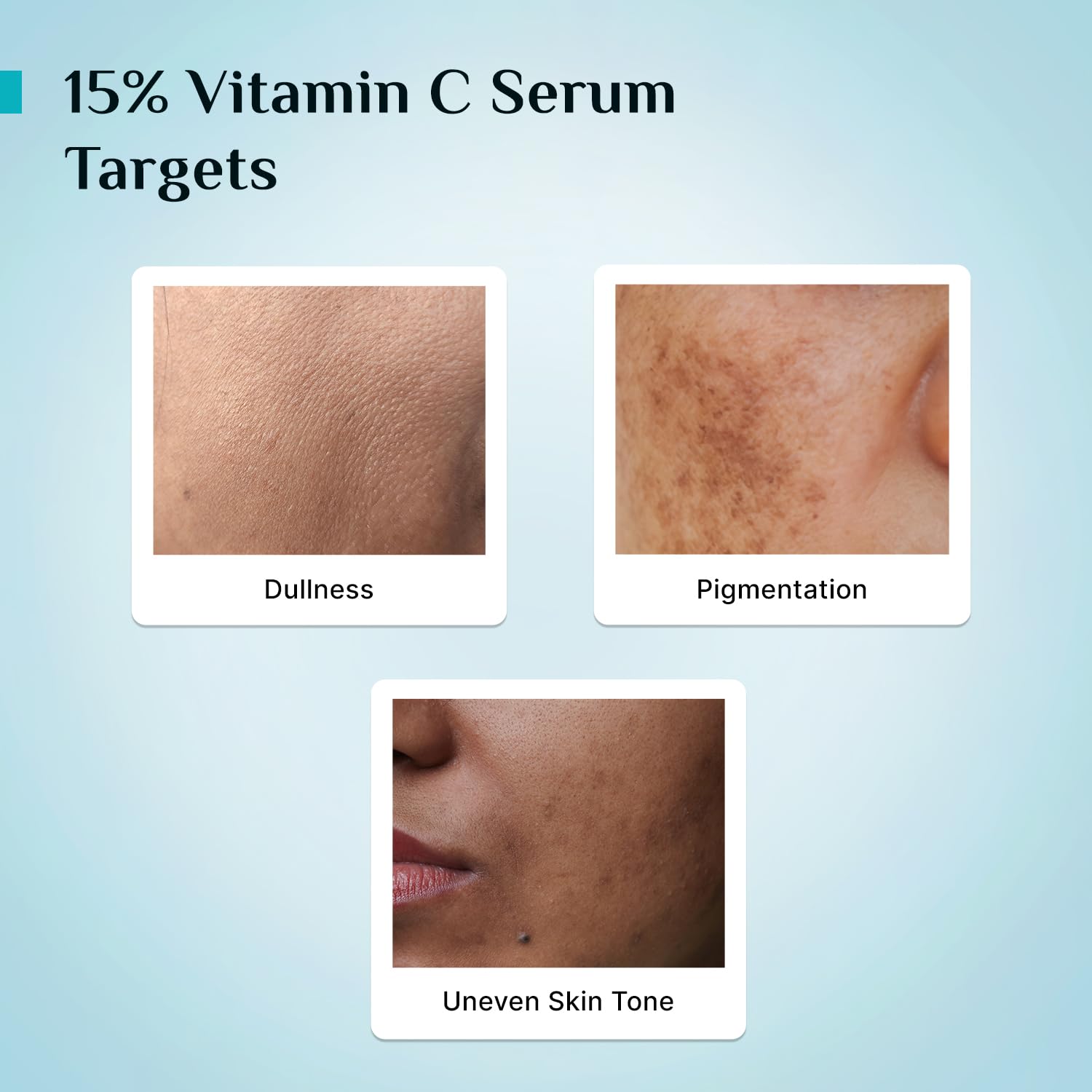 Pilgrim 15% Vitamin C Serum 10ml for Glowing Skin with Ferulic Acid & Kakadu Plum | Advanced Dark Spot Corrector, Hyperpigmen