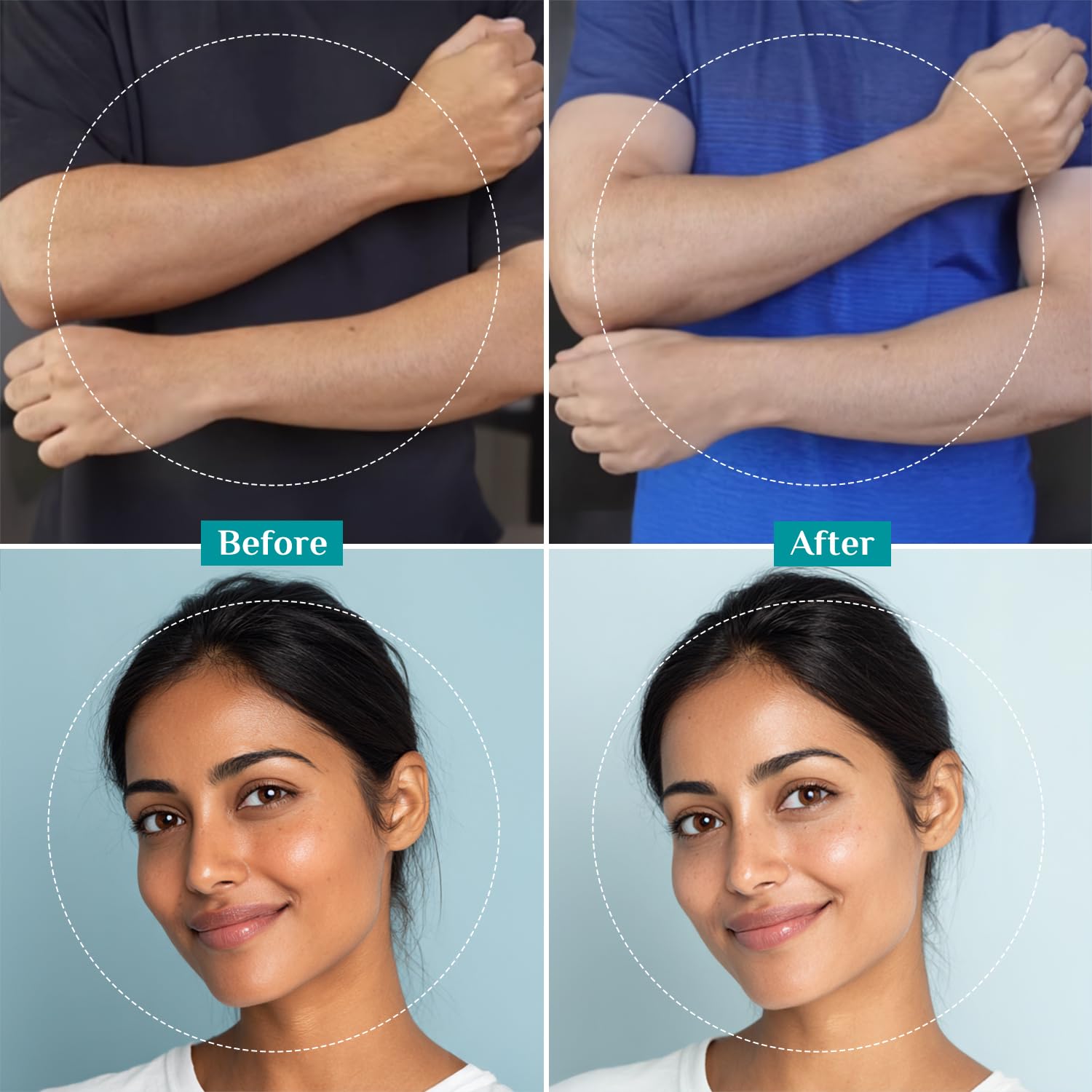 Pilgrim 25% AHA + 2% BHA + 5% PHA Peeling Solution For Tan Removal - 10ml |10-Minute Facial At Home | Advanced Exfoliating Pe