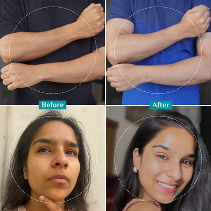 Pilgrim 25% AHA + 2% BHA + 5% PHA Peeling Solution For Tan Removal - 10ml |10-Minute Facial At Home | Advanced Exfoliating Pe