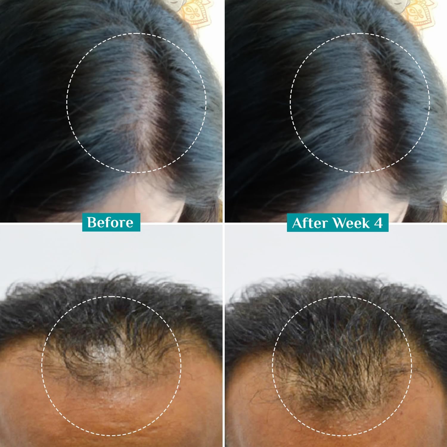 Pilgrim 3% Redensyl, 4% Anagain, 5% Capilia Stem Hair Serum Roll-on with Korean Black Rice & Rosemary, 25ml - packaging (13)