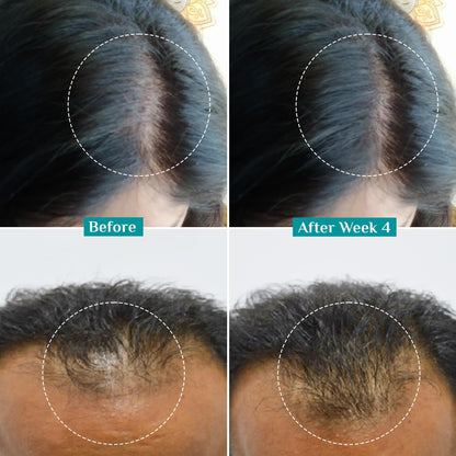 Pilgrim 3% Redensyl, 4% Anagain, 5% Capilia Stem Hair Serum Roll-on with Korean Black Rice & Rosemary, 25ml - packaging (13)