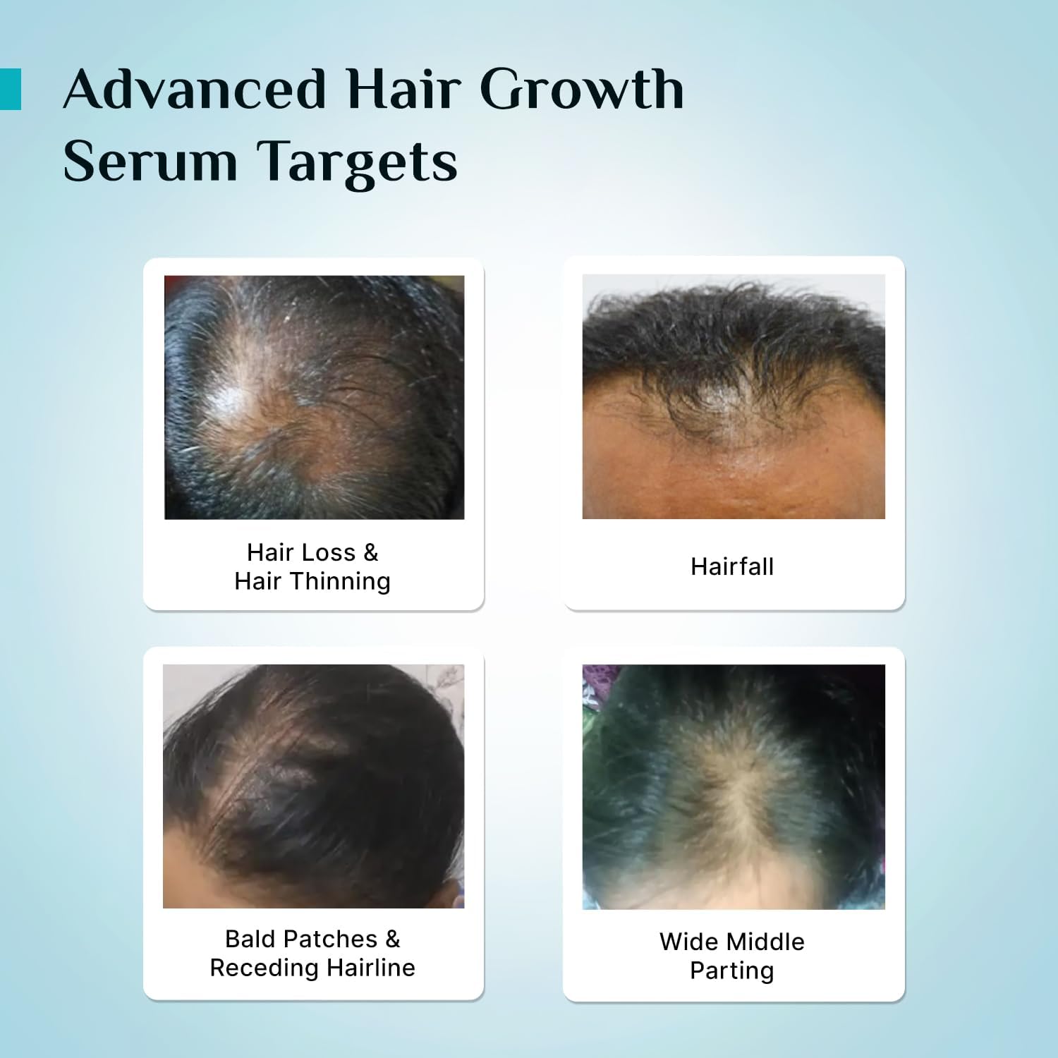 Pilgrim 3% Redensyl, 4% Anagain, 5% Capilia Stem Hair Serum Roll-on with Korean Black Rice & Rosemary, 25ml - ingredients pan