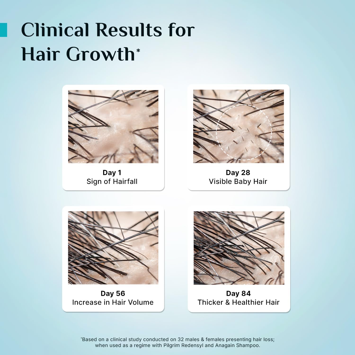 Pilgrim 3% Redensyl, 4% Anagain, 5% Capilia Stem Hair Serum Roll-on with Korean Black Rice & Rosemary, 25ml - close-up detail