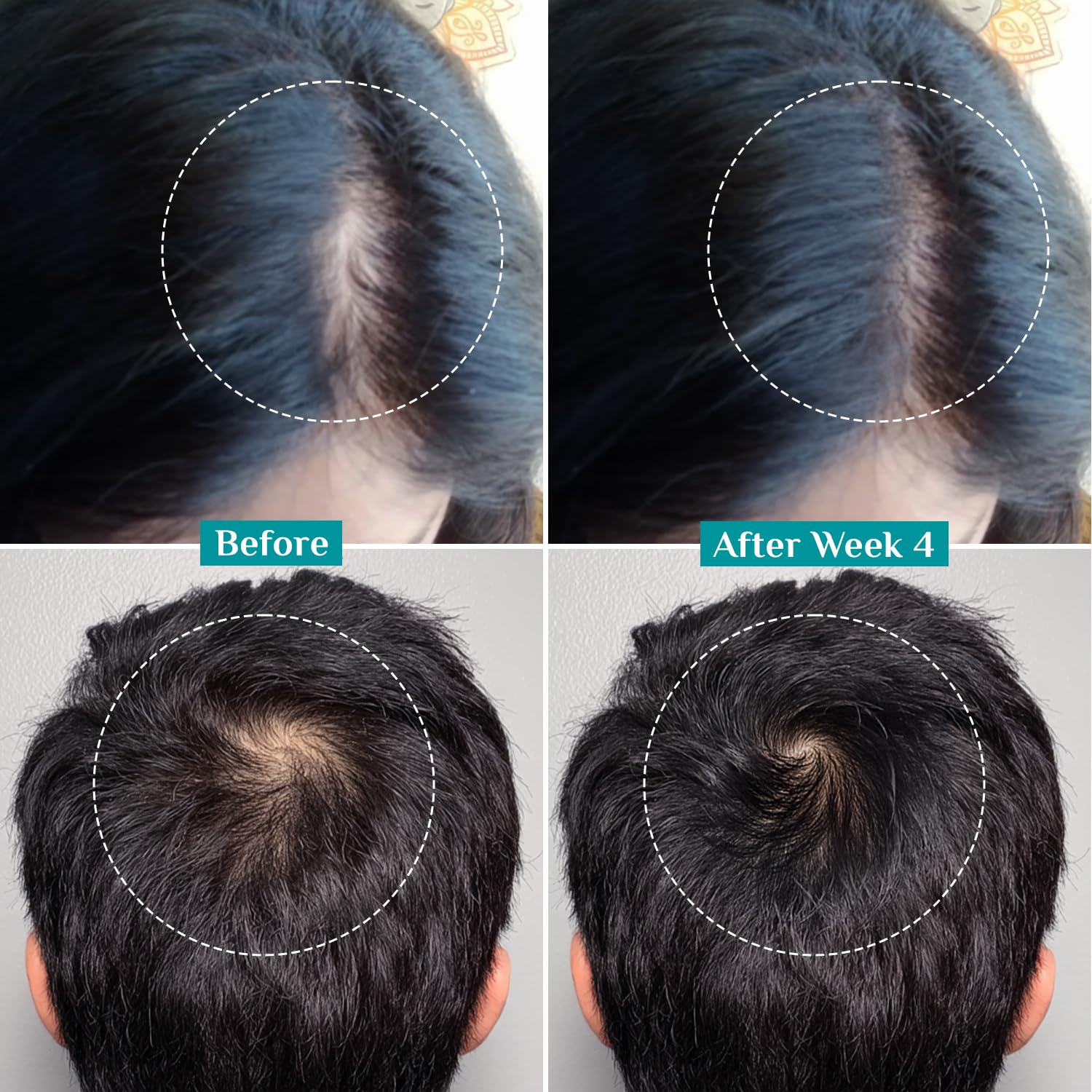 Pilgrim 3% Redensyl, 4% Anagain, 5% Capilia Stem Hair Serum Roll-on with Korean Black Rice & Rosemary, 25ml - ingredients pan